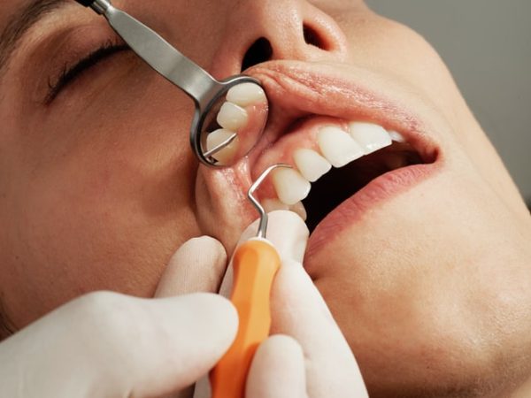 Top Tips For Healthy Teeth: Dentist Guide